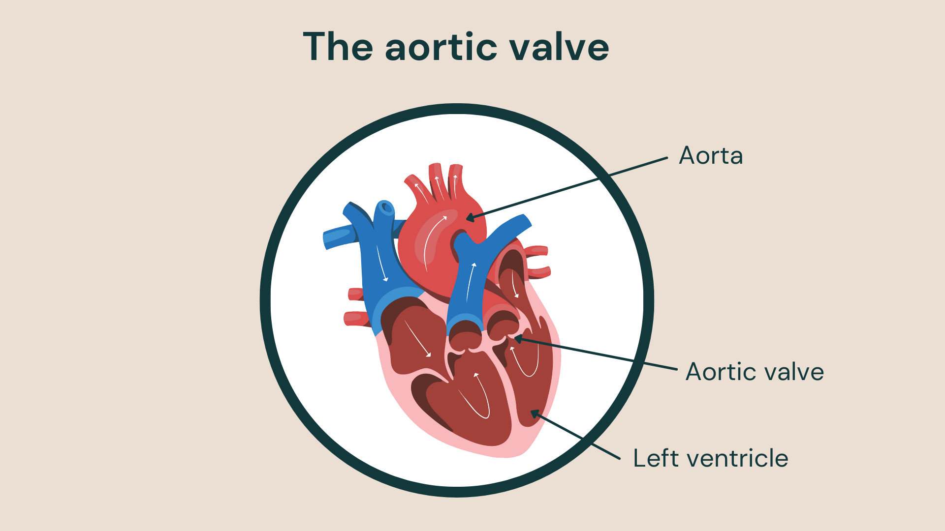 Illustration showing the aortic valve