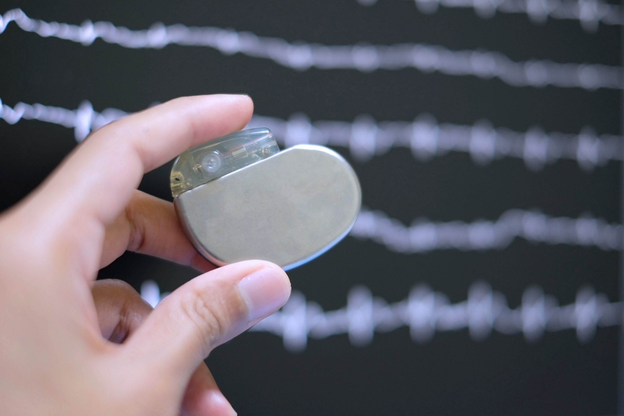 Pacemakers help the heart to beat more regularly