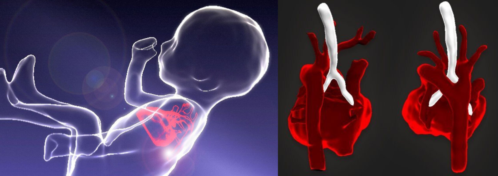 Revolutionary technology produces three-dimensional fetal cardiac images of the heart before birth