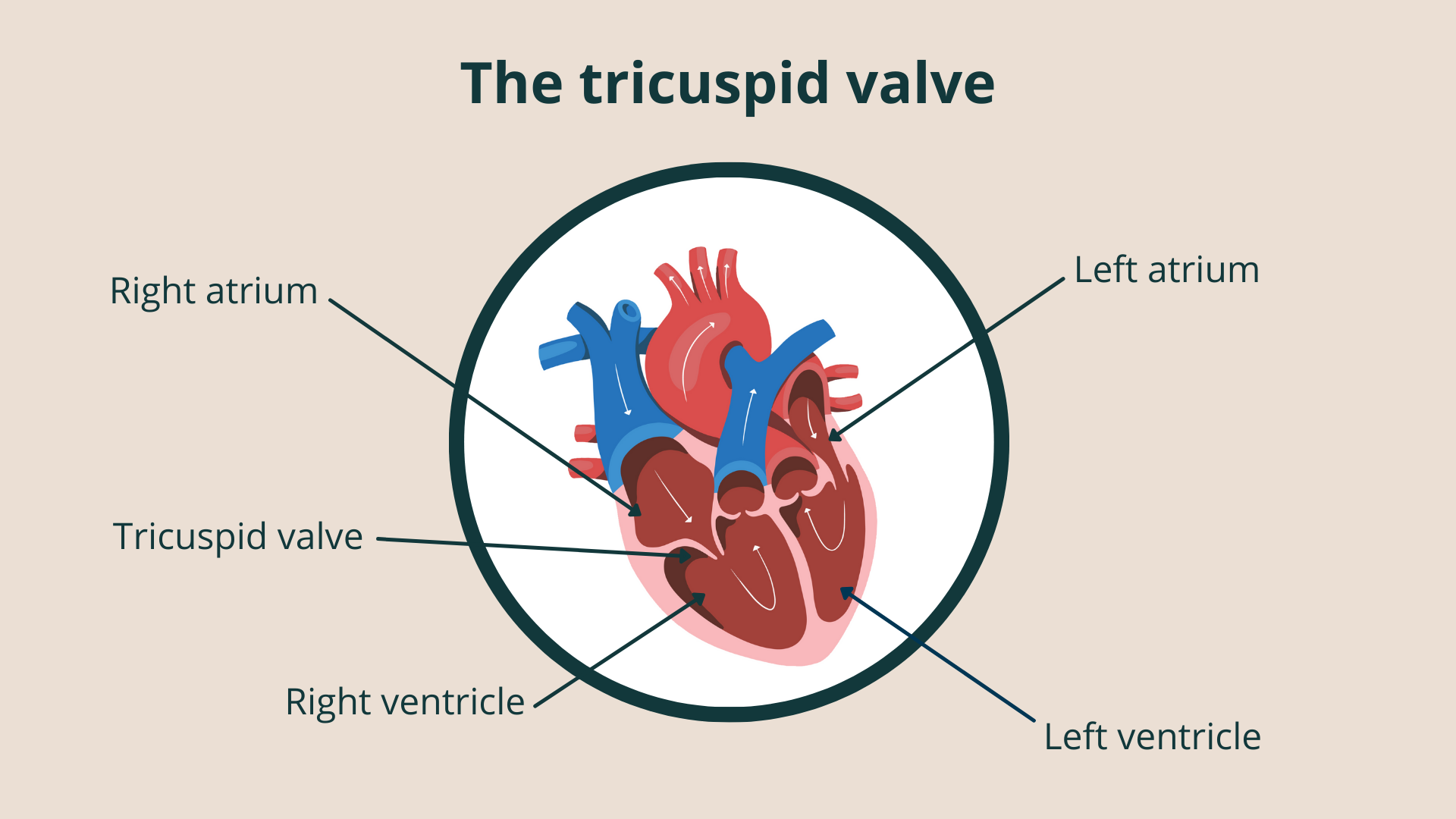 An illustration showing the location of the tricuspid valve