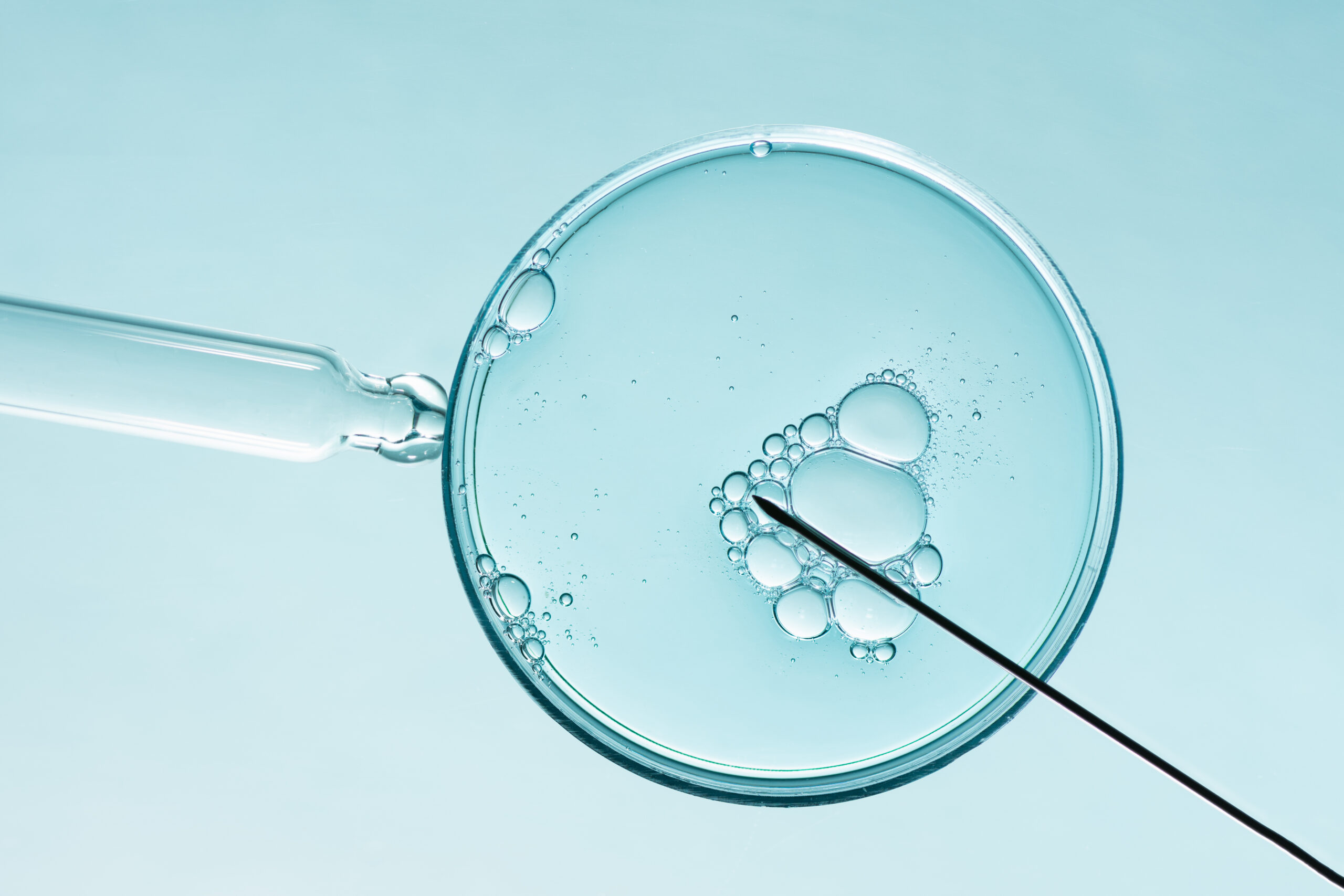 IVF ICSI fertility treatment