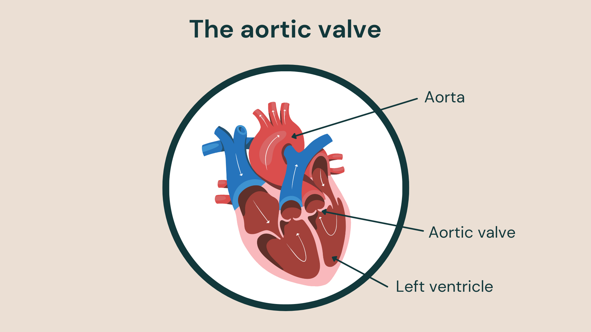 Aortic valve