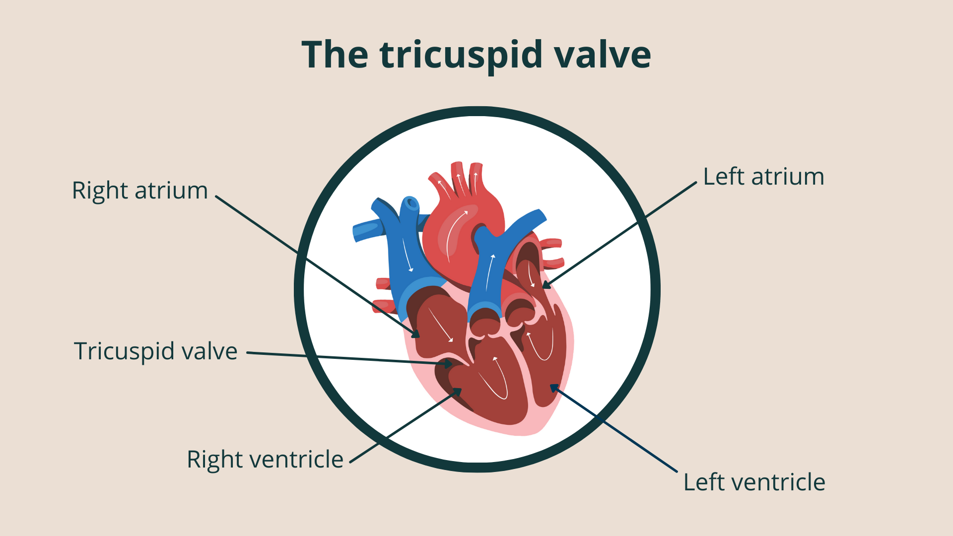 Tricuspid Valve Repair And Replacement